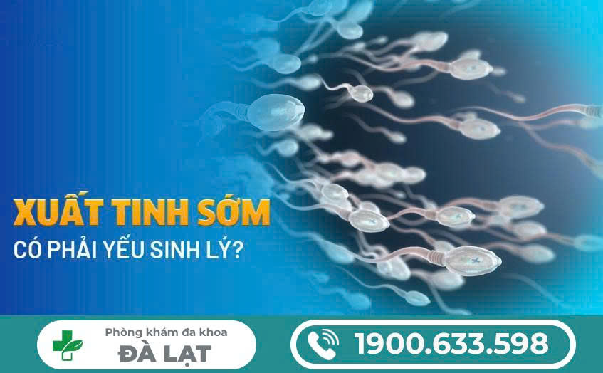 Hình ảnh minh họa